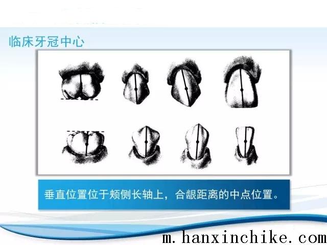 正畸托槽粘接位置